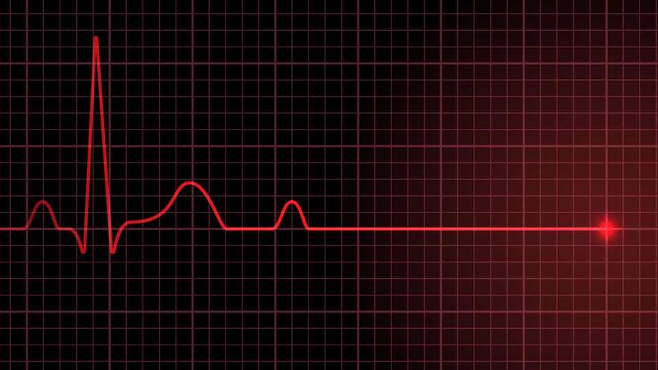 cardio